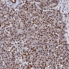 Immunohistochemical staining of human Pancreas shows strong nuclear positivity in exocrine glandular cells.