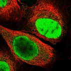 Immunofluorescent staining of human cell line A-431 shows localization to nucleoplasm.