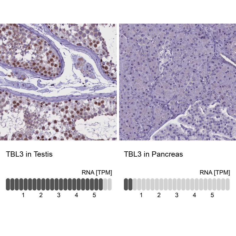 Anti-TBL3 Antibody