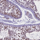 Immunohistochemical staining of human testis shows high expression.
