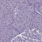Immunohistochemical staining of human pancreas shows low expression as expected.