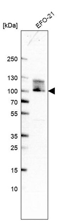 Western blot analysis in human cell line EFO-21.