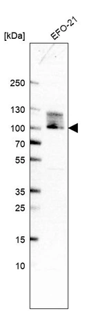 Western blot analysis in human cell line EFO-21.