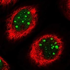 Immunofluorescent staining of human cell line A-431 shows localization to nucleus & nucleoli.