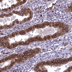 Immunohistochemical staining of human endometrium shows strong cytoplasmic positivity in glandular cells.