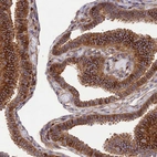 Immunohistochemical staining of human Fallopian tube shows strong cytoplasmic positivity in glandular cells.