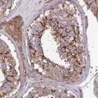 Immunohistochemical staining of human testis shows strong cytoplasmic positivity in cells in seminiferous ducts.