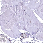 Immunohistochemical staining of human skeletal muscle shows no positivity in myocytes as expected.