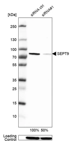 Western blot analysis in Hep-G2 cells transfected with control siRNA, target specific siRNA probe #1, using Anti-SEPT9 antibody. Remaining relative intensity is presented. Loading control: Anti-GAPDH.