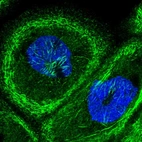 Immunofluorescent staining of human cell line A-431 shows localization to actin filaments.