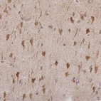 Immunohistochemical staining of human cerebral cortex shows strong cytoplasmic positivity in neurons.