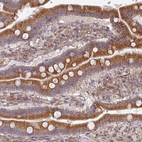 Immunohistochemical staining of human duodenum shows strong cytoplasmic positivity in glandular cells.