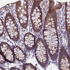Immunohistochemical staining of human colon shows strong granular cytoplasmic positivity in glandular cells.