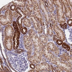 Immunohistochemical staining of human kidney shows strong granular cytoplasmic positivity in cells in tubules.