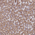 Immunohistochemical staining of human liver shows moderate granular cytoplasmic positivity in hepatocytes.
