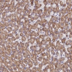 Immunohistochemical staining of human liver shows moderate granular cytoplasmic positivity in hepatocytes.