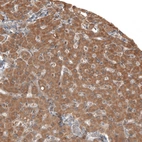 Immunohistochemical staining of human liver shows moderate cytoplasmic positivity in hepatocytes.