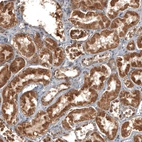 Immunohistochemical staining of human kidney shows moderate cytoplasmic positivity in cells in tubules.