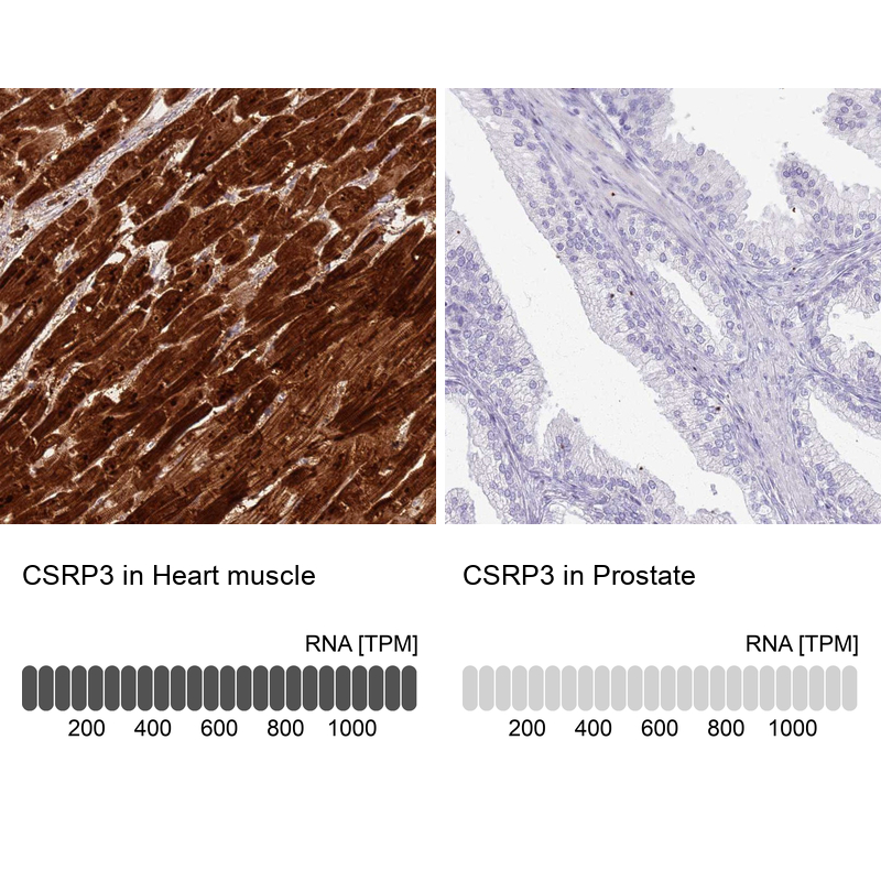 Anti-CSRP3 Antibody