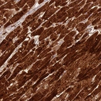 Immunohistochemical staining of human heart muscle shows high expression.