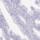 Immunohistochemical staining of human prostate shows low expression as expected.
