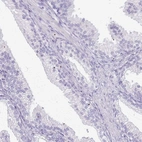Immunohistochemical staining of human prostate shows low expression as expected.