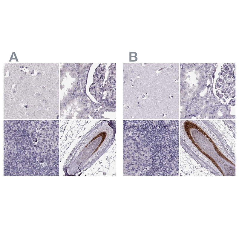 Anti-TCHHL1 Antibody