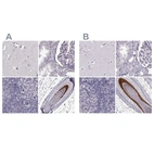 Anti-TCHHL1 Antibody