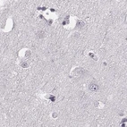 Immunohistochemical staining of human cerebral cortex using Anti-TCHHL1 antibody HPA042579.