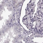 Immunohistochemical staining of human kidney using Anti-TCHHL1 antibody HPA042579.