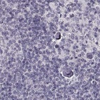 Anti-TCHHL1 Antibody