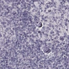 Immunohistochemical staining of human lymph node using Anti-TCHHL1 antibody HPA042579.