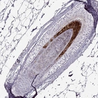 Immunohistochemical staining of human skin, hairy using Anti-TCHHL1 antibody HPA042579.