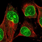 Immunofluorescent staining of human cell line U-251 MG shows localization to nucleoli & nuclear membrane.