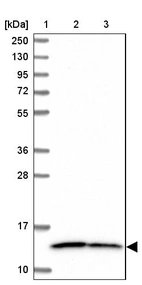 Lane 1: Marker [kDa] 250, 130, 95, 72, 55, 36, 28, 17, 10_br/_Lane 2: Human cell line RT-4_br/_Lane 3: Human cell line U-251MG sp