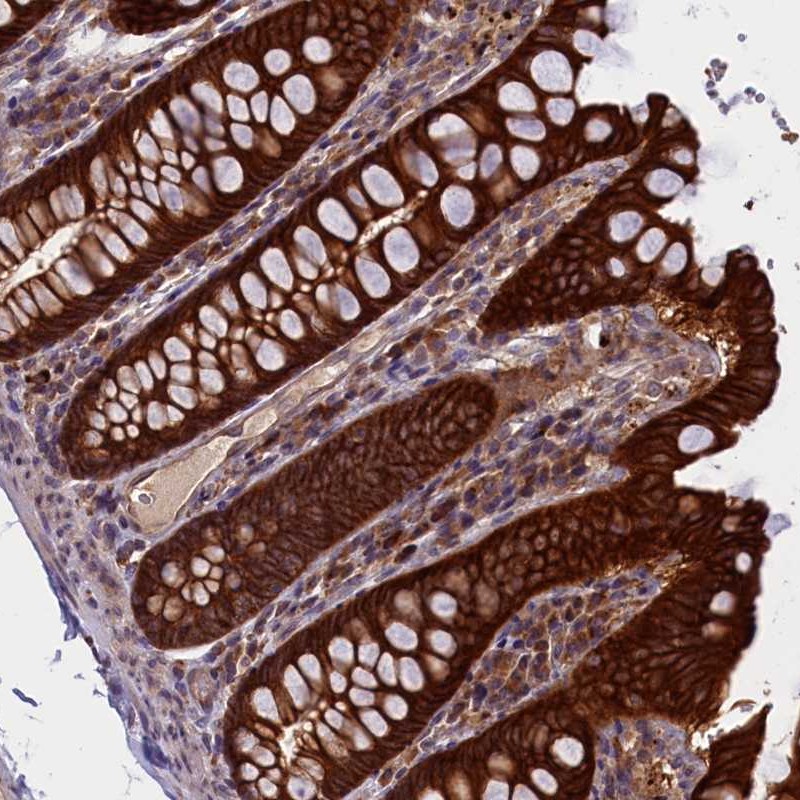 Anti-DENND1B Antibody