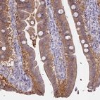 Anti-AHCYL1 Antibody