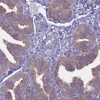 Immunohistochemical staining of human fallopian tube shows moderate membranous positivity in glandular cells.