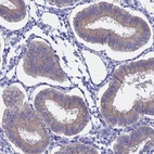 Immunohistochemical staining of human endometrium shows weak membranous positivity in glandular cells.