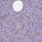 Immunohistochemical staining of human pancreas shows moderate membranous positivity in exocrine glandular cells.