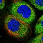 Immunofluorescent staining of human cell line A-431 shows localization to cytosol.