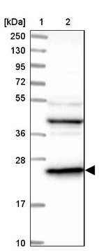Lane 1: Marker [kDa] 250, 130, 95, 72, 55, 36, 28, 17, 10_br/_Lane 2: Human cell line RT-4