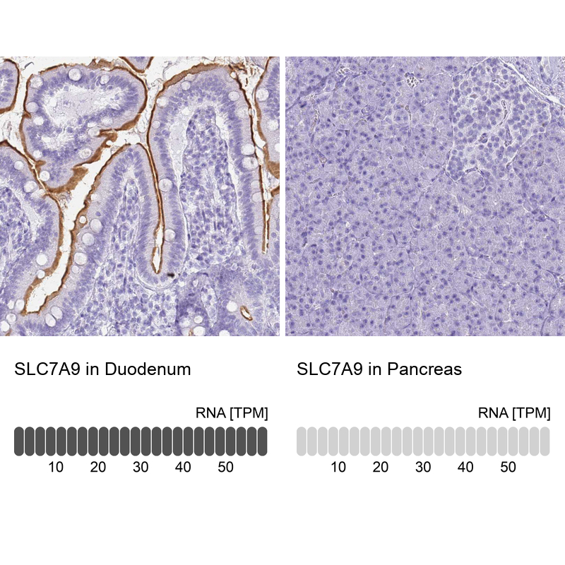 Anti-SLC7A9 Antibody