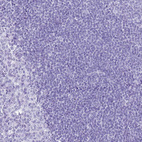 Anti-SLC7A9 Antibody