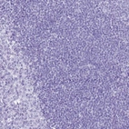 Immunohistochemical staining of human tonsil shows no positivity in non-germinal center cells as expected.