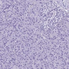 Immunohistochemical staining of human pancreas shows no positivity in exocrine glandular cells as expected.
