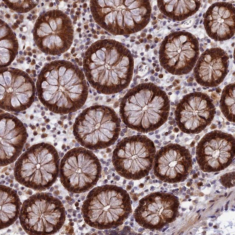 Anti-ZNF428 Antibody