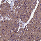 Anti-PIKFYVE Antibody