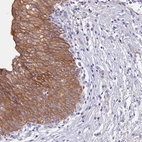 Anti-GK5 Antibody