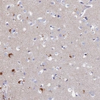 Anti-ACP7 Antibody